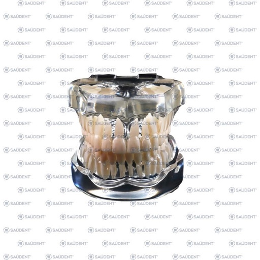 [66804] TIPODONTO ACRILICO TRANSPARENTE SIN BRACKETS 1PZ