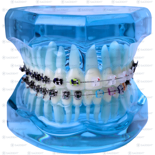 [67075] TIPODONTO AZUL SAÚDENT MIXTO 4 TIPOS 1PZ
